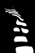 Nome File=bones.jpg
Dimensione File=42KB
Dimensioni=800x1200
Data aggiunta=Mar 20, 2021 bones.jpg
