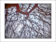 Nome File=spidertree(2).jpg
Dimensione File=340KB
Dimensioni=1200x900
Data aggiunta=Giu 14, 2019 spidertree(2).jpg